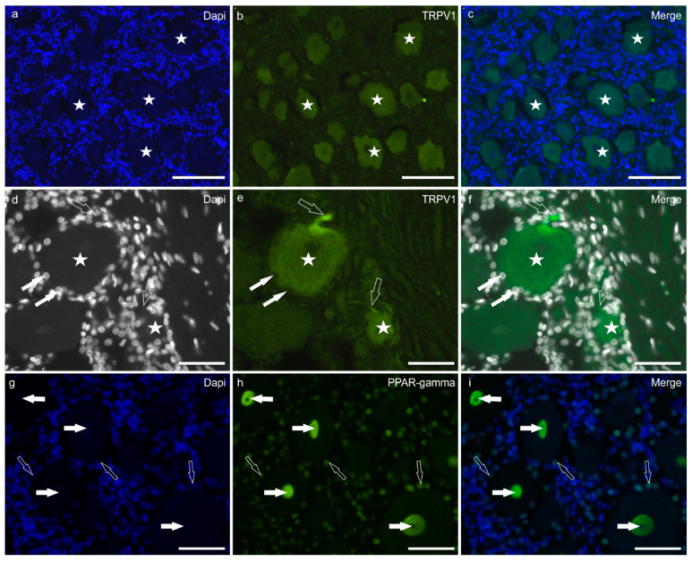 Photomicrographs of equine trigeminal ganglion cryosections showing immunoreactivity for the cannabinoid-related receptor TRPV1 (transient receptor potential vanilloid 1) (a–f), and PPARγ (Peroxisome proliferator-activated receptor gamma) (g–i). (a–f) Stars indicate sensory neurons expressing moderate-to-bright TRPV1 immunoreactivity. The white arrows indicate the Dapi labelled nuclei of satellite glial cells surrounding a large neuron expressing faint TRPV1 immunoreactivity. The open arrows indicate two TRPV1 immunoreactive axon hillocks arising from two sensory neurons. (g–i) The white arrows indicate neuronal nuclei expressing bright PPARγ immunoreactivity. The open arrows indicate the nuclei of satellite glial cells showing moderate PPARγ immunoreactivity. Bar: 50 µm.