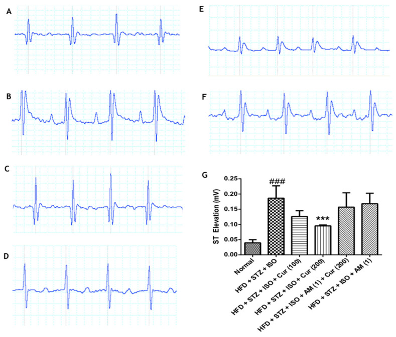 Curcumin improved the electrocardiogram in HFD-fed myocardial infarcted diabetic mice. (A) Normal; (B) HFD + STZ + ISO; (C) HFD + STZ + ISO + Cur (100); (D) HFD + STZ + ISO + Cur (200); (E) HFD + STZ + ISO + AM (1) + Cur (200); (F) HFD + STZ + ISO + AM (1); (G) ST height. The data were expressed as mean ± SEM, and analyzed by a one-way analysis of variance (ANOVA) followed by Bonferroni’s post hoc test. ### p < 0.001 vs. normal; *** p < 0.001 vs. HFD + STZ + ISO. AM: AM630; Cur: Curcumin; HFD: High-fat diet; ISO: Isoproterenol; STZ: Streptozotocin.