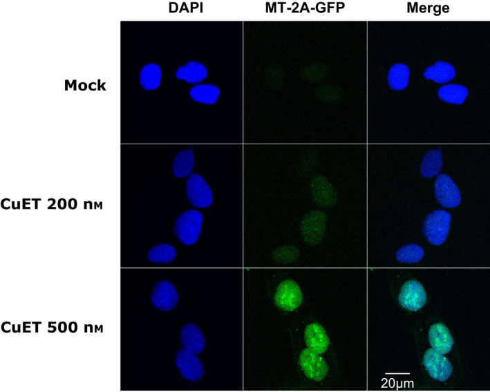 Bis‐diethyldithiocarbamate‐copper complex CuET treatment immobilizes MT‐2A‐GFP. MT‐2A‐GFP protein is immobilized after CuET treatment revealed as depicted by microscopic images after Triton X‐100 based pre‐extraction. Cells were treated with 0.2 and 0.5 μm CuET for 3 h (20 µm scale bar). The figure represents one of two independent experiments (n = 2).
