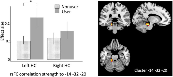 Seed-to-voxel analysis using bilateral hippocampi as seeds, contrasting older cannabis users vs. older cannabis non-users. Hippocampal seeds show stronger correlation to a cluster in left cerebellum at in older cannabis users vs. older non-users. Left, effect sizes of left vs. right hippocampus connectivity to the peak voxel in older non-users (stippled bar) and older users (solid bar); Right, warm colors represent significant voxels of heightened connectivity from hippocampus, overlaid on canonical anatomical scan (peak voxel at x = –14, y = –32, z = –20). HC, hippocampus. Asterisk indicates p < 0.00001, error bars indicate 95% C.l.
