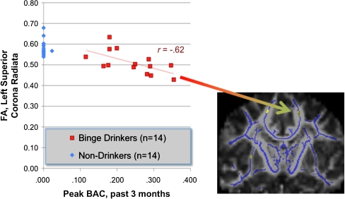Adolescents with histories of binge drinking show lower fractional anisotropy (FA) in the left and right superior corona radiata as compared to those with no history of binge drinking. Further, FA values here were linearly linked to blood alcohol concentrations reached in the previous 3 months, with more intense drinking linked to more abnormal white matter coherence in this dorsal frontal tract (McQueeny et al. 2009)
