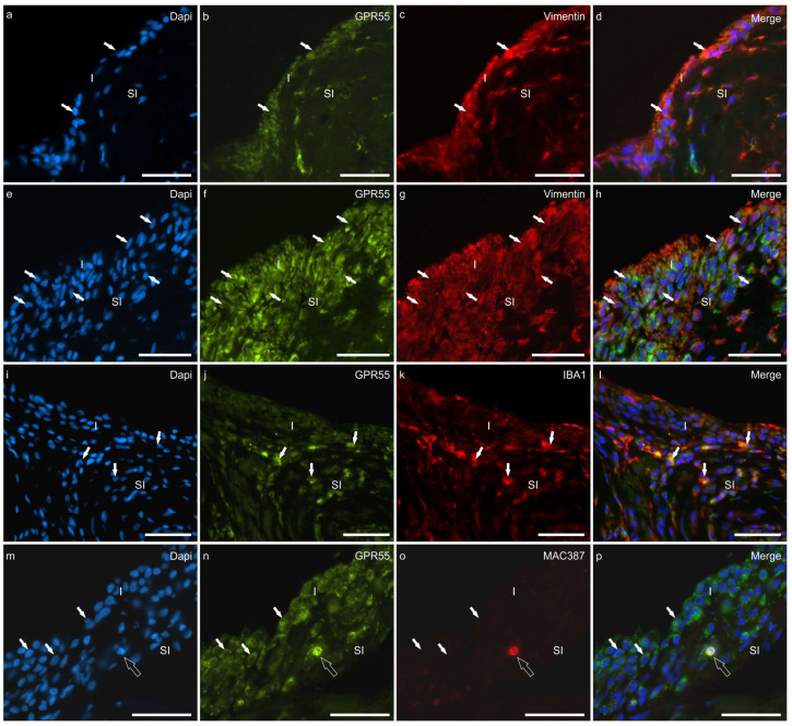 Photomicrographs of cryosections of the synovial membrane of the hip (a–d) and stifle (e–p) joints of dogs showing colocalisations of the antibody anti-G protein-coupled receptor 55 (GPR55) with the antibodies directed against the fibroblast marker vimentin (a–h), the macrophage marker IBA1 (i–l), and the neutrophils marker MAC387 (m–p). (a–h) the arrows indicate some synoviocytes (fibroblast-like synoviocytes) which were immunoreactive for GPR55 and vimentin. The different thicknesses of the epithelium lining the joint cavity of the hip (a–d) and stifle (e–h) joints (stifle > hip) should be noted. (i–l) The arrows indicate some macrophage-like synoviocytes which coexpressed GPR55 and IBA1 immunoreactivity. Given that the cut of the synovial membrane does not appear perfectly orthogonal, it cannot, however, be excluded that some IBA1 immunoreactive R cells are subintimal macrophages. (m–p) The white arrows indicate some synoviocytes expressing GPR55 immunoreactivity. The open arrow indicates one subintimal neutrophil, with a dapi-labelled polilobated nuclei, coexpressing GPR55 and MAC387 immunoreactivity. Abbreviations: I, intima; SI, subintima. Bar: 50 µm.
