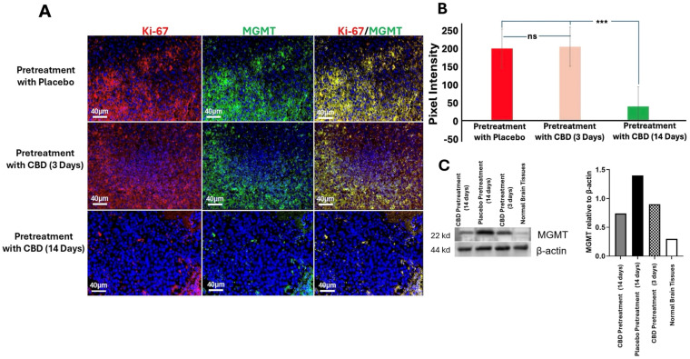 Inhaled CBD Pretreatment Reduces MGMT and Ki-67 in GBM Tumors. (A) Immunofluorescence staining of MGMT and Ki-67 in GBM tumors from mice pretreated with inhaled CBD for 14 days, 3 days, or placebo. Representative images show that MGMT and Ki-67 levels were significantly reduced in the 14-day CBD pretreatment group compared to both the 3-day CBD and placebo groups (Scale bar: 40 μm). (B) Quantification of staining intensity revealed significantly lower levels of MGMT and Ki-67 in the 14-day CBD pretreatment group compared to the 3-day CBD and placebo groups (*** p < 0.001, ns = not significant). These results suggest that CBD pretreatment reduces key biomarkers associated with chemotherapy resistance and tumor proliferation, potentially enhancing therapeutic sensitivity. (C) To further validate the effect of CBD on tumor progression, we assessed MGMT expression levels using Western blotting. The blot shows increased MGMT expression in the GBM tumors of mice pretreated with placebo (lane 2) compared to the normal brain tissue used as a negative control (lane 4). Long-term CBD pretreatment (14 days, lane 1) significantly reduced MGMT expression in the tumor compared to acute CBD pretreatment (3 days, lane 3), corroborating the reduction observed in the immunofluorescence analysis.