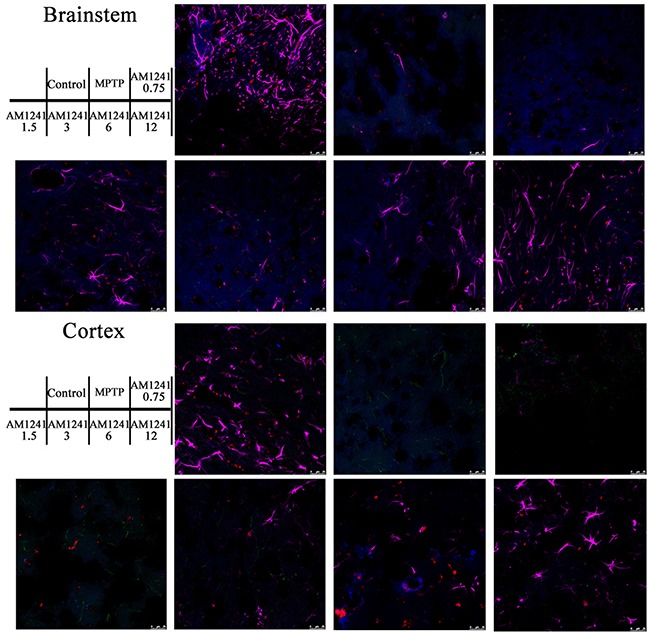 Immunostaining of microglia in substantianigra of MPTP-induced PD miceIBA1-positive cells represent for microglia, only a few co-localizations of CB2 receptor and IBA1-positive cells could be seen.
