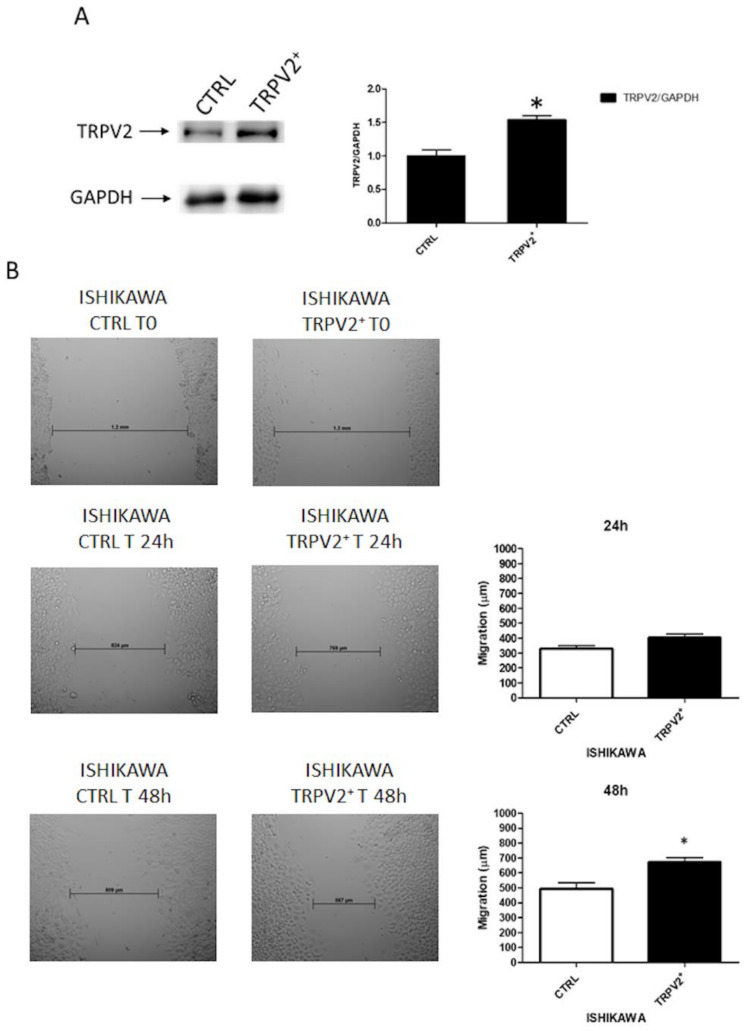 TRPV2 over-expression enhanced migration of EC cells. (A) Western blot analysis of TRPV2 and GAPDH protein levels in untransfected (CTRL) and TRPV2-transfected Ishikawa cells. Blots are representative of one of three separate experiments. TRPV2 densitometry values were normalized to GAPDH used as loading control and normalized. Densitometric values shown are the mean ± SD of three separate experiments. * p < 0.05 vs. control cells. (B) Wound-healing assays for Ishikawa cells after TRPV2 over-expression. All experiments were repeated three times. Data are presented as the mean ± SD. * p < 0.05 vs. control.
