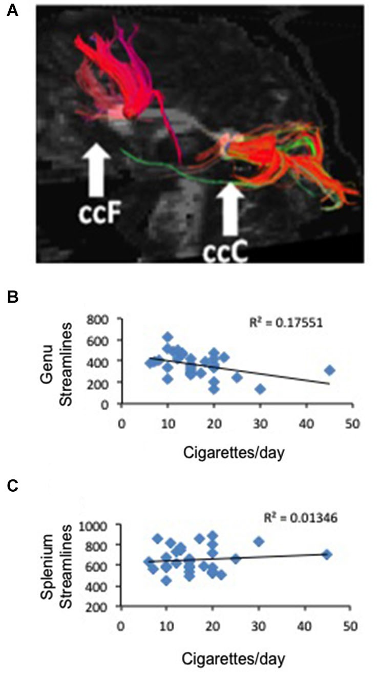 Correlation between frontal anatomical connectivity as measured with DTI and average number of cigarettes smoked per day. (A) Two callosal ROIs (genu and splenium) and streamlines that pass through each ROI (one representative subject is shown) (B) Significant negative correlation between number of streamlines in the genual ROI and average number of cigarettes per day p < 0.02. (C) No correlation between number of streamlines in the splenium ROI and average number of cigarettes per day.