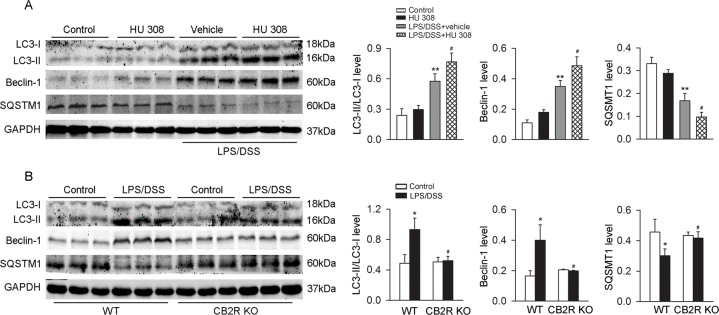 CB2R augments autophagy in peritoneal macrophages stimulated with LPS/DSS.After LPS (10 ng/ml) priming for 1 h, peritoneal macrophages were stimulated with 3% DSS in the presence or absence of HU 308 (10 μM) for 24 h. In another set of experiments, peritoneal macrophages from WT and CB2R KO mice were isolated and stimulated with/without LPS/DSS for 24h. Macrophages were collected and LC3-II/LC3-I, Beclin-1 and SQSTM1 were analyzed using Western blot. (A) Pre-incubated with HU 308 significantly increased the level of LC3-II/LC3-I, Beclin-1 and decreased the level of SQSTM1. n = 6 per group. **P<0.01 vs. control, #P<0.05 vs. vehicle. (B) The expression of LC3-II/LC3-I and Beclin-1 were decreased and the expression of SQSTM1 was increased in CB2R KO group. n = 6 per group. *P<0.05 vs. control, #P<0.05 vs. WT.