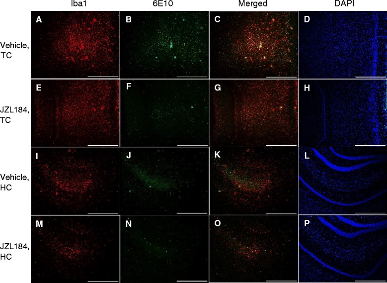 The level of microgliosis and total Aβ burden in JZL184 and vehicle-treated tg APdE9 mice. Similar to Figure 1, JZL184 treatment reduced Iba1 immunoreactivity in (A, E) temporal cortex (TC) and (I, M) hippocampus (HC) and 6E10 immunoreactivity in (B, F) TC and slightly in (J, N) HC of tg APdE9 mice when compared to mice treated with vehicle only. Merged images from TC (C, G) and from HC (K, O). DAPI-stained nuclei from the responsive areas in D, H, L and P. Scale bars indicate 500 μM.