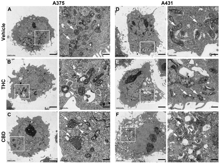 Influence of THC and CBD on the mitochondrial structure of A375 and A431 cells. Representative images from the transmission electron microscopy of A375 (A–C) and A431 cells (D–F) treated for 24 h with vehicle (A,D), 6 µM THC (B,E) or 6 µM CBD (C,F). The images on the right of a treatment group (scale bar: 500 nm) are enlarged views of the areas outlined by white boxes in the corresponding left image (scale bar: 2 µm). The structures highlighted with white arrows in the enlarged views represent intact mitochondria (vehicle) vs. damaged mitochondria (THC, CBD), while white arrowheads mark altered mitochondria-associated ER membranes (CBD).