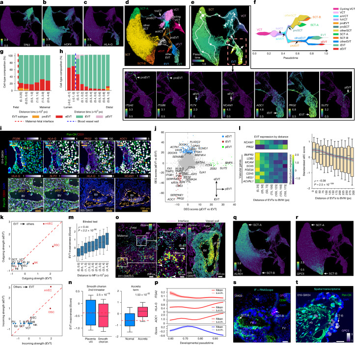 Molecular and spatial characterization of human trophoblast development and function.a–c, UMAPs of trophoblast subtypes by marker expression: TP63+ VCTs (a), HOPX+ SCTs (b) and HLA-G+ EVTs (c). d, Clustering of trophoblast subtypes: iEVT, eEVT, pEVT, giant cell (GC), floating villi VCT (fvVCT), anchoring villi VCT (avVCT), EVT progenitor (proEVT) and SCT progenitor (proSCT). e, Reconstructed pseudotime trajectory reveals divergent developmental paths in floating versus anchoring villi by UMAP (top). Bottom, expression of EVT subtype-specific markers on UMAP: proEVT (ITGA2 and ITGB6), eEVT (FLT4 and NCAM1), iEVT (AOC1 and PRG2) and pEVT (SLIT2). f, Stream plot mapping VCT differentiation. Major branches are shown. g,h, Proportion of EVT subtypes identified in the decidua binned as the distance from the MFI (g) or maternal blood vessel walls (h). i, Spatial transcriptomics with pan-CK and CD31 immunostaining localized EVT subtypes, which were marked by HLA-G versus ITGB6 (proEVT), PRG2 and AOC1 (iEVT), SLIT2 (pEVT) and NCAM1 (eEVT). Images highlight EVT positioning near anchoring villi or blood vessels. j, Differential expression analysis (pEVT versus iEVT and eEVT versus iEVT) identified subtype-specific signatures. DEG, differentially expressed gene. k, CellChat identified distinct outgoing (top) and incoming (bottom) interactions, reciprocal signalling (eEVTs and mVECs), and crosstalk (EVTs and decidual cells). iEVTs showed strong outgoing interactions towards NK cells. l, Validation of the EVT pseudovascularization model. Left, EVTs adjacent to vessel walls exhibited high expression of endothelial signatures. Right, positive correlation of endothelial gene scores in EVTs with proximity to vessel walls (n = 9,374 EVTs from 16 samples). In box plots, the centre line is the median, box represents the IQR, and whiskers show minima and maxima (0.5× IQR) end-points. P value, Spearman (two-tailed) correlation test. m, A sparse learning model predicts EVT invasiveness from single-cell transcriptomes. Invasiveness scores (iScores) were positively correlated with EVT decidual depth in the test set (n = 63,916 EVTs from 16 samples). In box plots, the centre line is the median, box represent the IQR, and whiskers show minima and maxima (0.5× IQR) end-points. P value, Spearman (two-tailed) correlation test. n, Benchmark iScores in independent studies. Left, reduced invasiveness of smooth chorion EVTs40. Right, EVT shows increased invasiveness in placental accreta spectrum41. In box plots, the centre line is the median, box represents the IQR, and whiskers show minima and maxima (0.5× IQR) end-points; outliers are not shown. P values, two-tailed Wilcoxon rank-sum test. o, Comparison of EVT invasiveness in superficial and deep decidual compartments (left and middle) and near blood vessels (right). p, Invasiveness (iScore; bottom) and expression of ITGA2 (progenitor), HLA-G (cell column exit) and AOC1 (advanced maturation) at EVT maturation stages along the reconstructed trajectories. q,r, Identification of a novel SCT terminal state with distinct expression of KLRD1 (encoding CD94) (q) and GPC5 (r) in SCT-A versus SCT-B. s, Immunolocalization (CD94) and RNAscope (GPC5) identifies CD94+ SCT-A in syncytium and GPC5+ SCT-B in syncytial knots of floating villi cells in a representative GW23 sample (n = 3). IF, immunofluorescence. Scale bar, 25 μm. t, Spatial transcriptomics independently confirmed the presence of the SCT-B subtype in a representative sample (016-GW24, n = 16). Immunostaining: pan-CK (green). Scale bar, 25 μm.Source data
