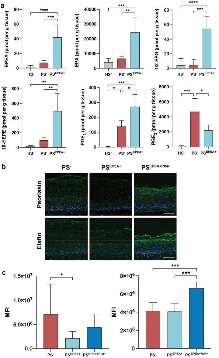 Effect of 10 μM EPEA on inflammation and psoriatic markers. (a) Levels of n-3-derived NAEs, various EPA-derived lipid mediators and PGE2 in healthy and psoriatic skin substitutes measured using LC–MS/MS (N = 2 donors, n = 2 reconstructed substitutes per donor). (b) Expression of psoriasin and elafin (green) in psoriatic substitutes as revealed by indirect immunofluorescence. Nuclei were stained with DAPI (blue). (c) Mean fluorescence intensity (MFI) of psoriasin and elafin measured by indirect immunofluorescence. Scale bars: 100 μm. Statistical significance was determined using one-way ANOVA followed by Tukey’s post-hoc test. *p < 0.05; **p < 0.01; ***p < 0.001. EPEA N-eicosapentaenoyl-ethanolamine, HS healthy substitute, PGE2 prostaglandin E2, PS psoriatic substitutes, RIM Rimonabant, DHEA N-docosahexaenoyl-ethanolamine, DPEA N-docosapentaenoyl-ethanolamine, EPEA N-eicosapentaenoyl-ethanolamine, HEPE hydroxy-eicosapentaenoic acid, HS healthy substitute, NAE N-acyl-ethanolamine, PGE3 prostaglandin E3, PS psoriatic substitute, RIM Rimonabant.