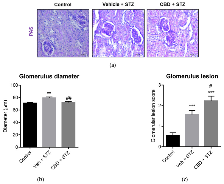 CBD worsens STZ-induced renal lesions in glomerulus. (a) Representative images of kidney stained with PAS from control, vehicle-STZ and CBD-STZ-treated mice (original magnification ×10, scale bar 50 μm). Quantification of (b) glomerulus diameter and (c) glomerular lesion score. Values are expressed as mean ± SEM (n = 6–7 animals per group). ** p < 0.01, *** p < 0.001 vs. vehicle-citrate buffer-treated mice (control); # p < 0.05, ## p < 0.01 vs. vehicle-STZ.