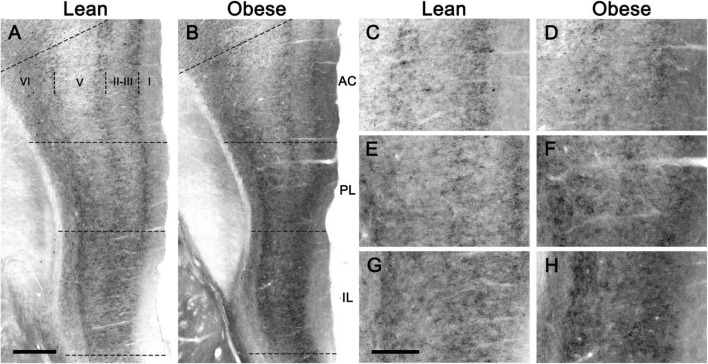 CB1-immunostaining in the medial prefrontal cortex of lean and obese Zucker rats. (A,B) Low power micrographs showing the distribution of CB1-immunostaining in representative coronal sections of the medial prefrontal cortex of a lean (A) and an obese (B) Zucker rat. (C–E) Higher magnification micrographs of the sections shown in (A,B), taken at the level of the anterior cingulate (C,D), prelimbic (E,F), and infralimbic (G,H) cortices. All images were captured under the same conditions and processed in parallel. AC, anterior cingulate cortex; IL, infralimbic cortex; PL, prelimbic cortex. Scale bars = 200 μm in (A) (applies to A,B); 400 μm in (G) (applies to C–H).