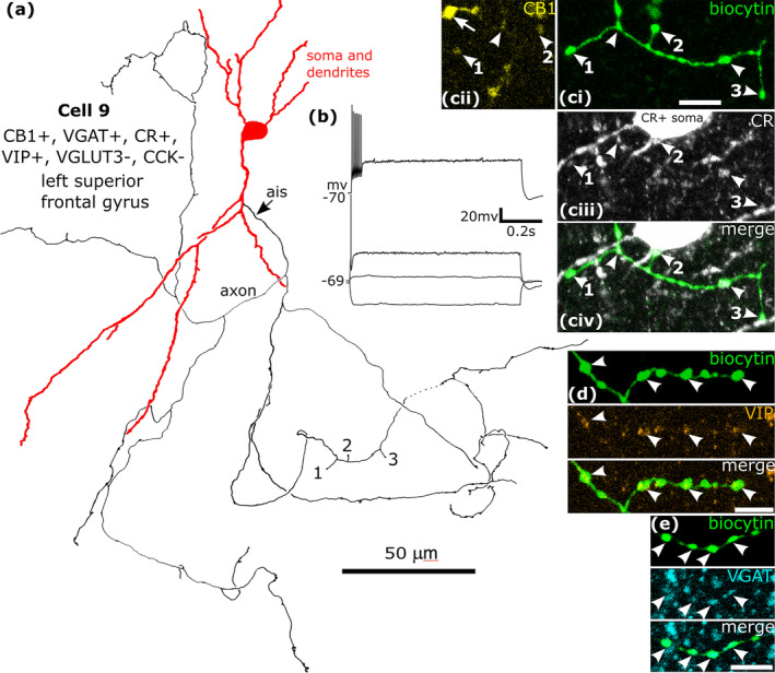 A CB1/VGAT/VIP/CR‐immunopositive neuron recorded and labelled by biocytin in layer 3. (a). Reconstruction of the recovered parts of the cell (cell 9 in Figure 8f) that was negative for CCK and VGLUT3, with soma and dendrites (red) and a low density axon originating from the descending dendrite (ais). Boutons 1, 2 and 3 are shown in (c). (b) Voltage responses of the cell to current injections +20 pA, rheobase, RB + 100 pA (upper trace), and holding current −100 pA; no significant voltage sag was detected to the hyperpolarising current injection. The cell fired with an initial burst and spike amplitude accommodation when continuously depolarised. (c) The axonal boutons (ci, arrowheads, green, see 1, 2 and 3 in (a)) were weakly CB1‐positive (civ), calretinin‐positive (cii, arrowheads) and some of them contacted a CR‐positive interneuron on the soma (2) and dendrites (1, 3). (d) The biocytin‐labelled boutons (green, e.g. arrowheads) were VIP‐positive (arrowheads). (e) The boutons (green, arrowheads) were immunoreactive for VGAT (blue). Maximum intensity projections of optical slices, Z‐stack total depth: (c), 2.3 μm; (d), 1.5 μm; (e), 1.7 μm. Scale bars: (c–e), 5 μm.