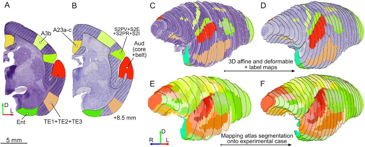 Registration-based segmentation of an individual case into cortical areas.Label-guided segmentation of individual hemispheres into cortical areas illustrated using an example case (CJ116). Different colors represent cytoarchitectural areas delineated manually to guide the coregistration with Paxinos et al. (2012) atlas. For detailed information on areas outlined in each hemisphere see Table S1. A, B: Example coronal sections (8.5 mm rostral to the interaural line) from the Paxinos et al. (2012) atlas (A) and the experimental (B) brain with a set of corresponding label maps indicated. The cerebral cortex was outlined (diagonal hatching) as an additional constraint. C-F: Rostrolateral views of reconstructions of the marmoset brain. Black outlines on every fifth section are provided to better illustrate the general shape of the image stack and are unrelated to the mapping process. C: reconstruction of the brain illustrated in the Paxinos et al. (2012) atlas. D: reconstruction of the experimental case. E: Segmentation of the Paxinos et al. (2012) atlas into cortical areas. F: Segmentation from panel E mapped onto the experimental case.