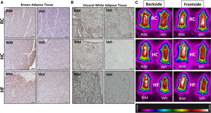 Thermogenic effect of rimonabant on brown and white adipose tissue across different diets(A and B) Immunohistochemical staining of UPC1 (reddish-brown) in (A) brown adipose tissue (BAT) and (B) visceral white adipose tissue (vWAT) of rimonabant vs. vehicle-treated C57BL/6J mice across several diet groups. RC, regular chow HC, high carbohydrates; HF, high fat. Scale bars, 100 μm.(C) In vivo recording of body heat temperature—measured by infrared (IR) camera—from the backside (BAT localized region [left]) and the frontside (vWAT localized region [right]) of C57BL/6J mice, 60 min after administration of rimonabant vs. vehicle across several diet groups. The colored heat grade legend is displayed below IR images. n = 3–4.