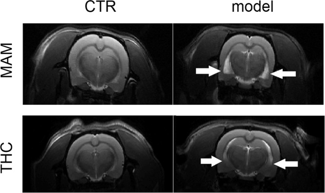 Lateral ventricles in the MAM and THC models. The figure shows anatomical (T2 weighted) images with visible ventricle enlargement present in MAM and THC exposed animals and their respective controls (CTR). White arrows point to the edges of the enlarged lateral ventricles.