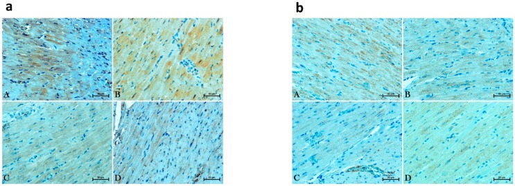 Representative images of glucose transporter 1—GLUT1 (a) and glucose transporter 4—GLUT4 (b) expressions in the left ventricular cardiomyocytes in the control Wistar Kyoto rats (WKY) and spontaneously hypertensive rats (SHRs), where (A) is WKY group, (B) WKY + URB597 group, (C) is SHR group and (D) SHR + URB597.