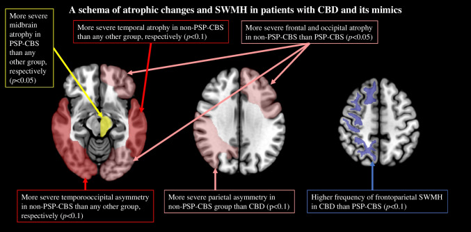 A schema of atrophic changes and SWMH in patients with CBD and its mimics. In this scheme, asymmetry and signal change were colored in the right hemisphere, and degree of brain atrophy was colored in the left hemisphere, respectively. CBD, corticobasal degeneration; CBS, corticobasal syndrome; PSP, progressive supranuclear palsy; SWMH, subcortical white matter hyperintensity