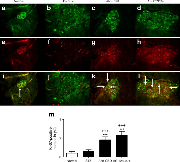 Immunocytochemical staining for insulin and Ki-67 in the pancreas of STZ-induced diabetic mice after 28 days of treatment with Abn-CBD, AS-1269574 or saline vehicle. (a–l) Representative images are shown for insulin (a–d), Ki-67 (e–h) and merged insulin and Ki-67 (i–l) Magnification × 40. (m) Percentage of Ki-67-positive beta cells. Values are means ± SEM for six mice, 25 islets per group. ***p < 0.001 compared with non-diabetic mice treated with saline; +++ p < 0.001 compared with diabetic mice. Arrows indicate insulin/Ki-67 co-positive beta cells