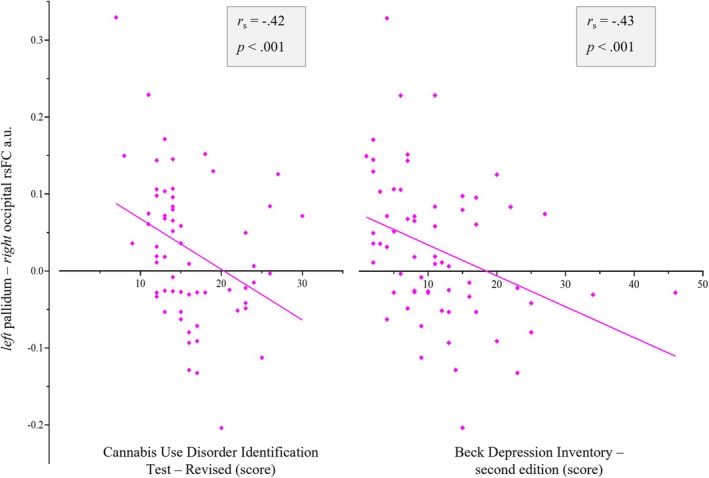 Spearman's rho (r s ) correlations within the CUD group, between rsFC pairs showing group differences (rsFC beta values) significantly correlated with metrics of cannabis exposure and related problems and depression scores, using Bonferroni adjusted alpha threshold of p < 0.001 (0.05 ÷ 45).
