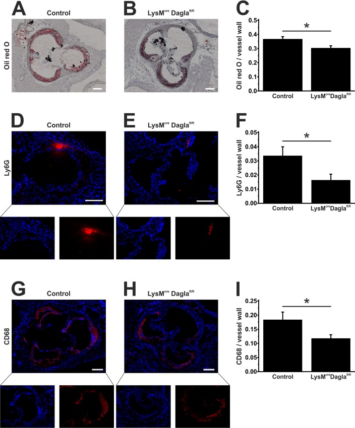 Assessment of plaque burden and plaque morphology.Frozen sections through the aortic sinus of both control mice and Dagla-deficient mice were stained using oil red O to visualise atherosclerotic plaques (A, B). Cumulative plaque area was divided by the size of the vessel wall to obtain relative plaque burden (C). Neutrophil granulocytes were identified by staining Ly6G (D, E). Ly6G positive areas were normalised to the size of the vessel wall (F). Macrophages were identified by staining CD68 (G, H). CD68 positive areas were normalised to the size of the vessel wall (I). Data are presented as mean ± standard error of the mean; n = 9–13; *, p < 0.05. Scale bar, 200 μm. CD, cluster of differentiation; cre, cyclisation recombination; Dagla, diacylglycerol lipase α; fl, flanked by loxP; Ly6G, lymphocyte antigen 6G; LysM, lysozyme 2 gene.