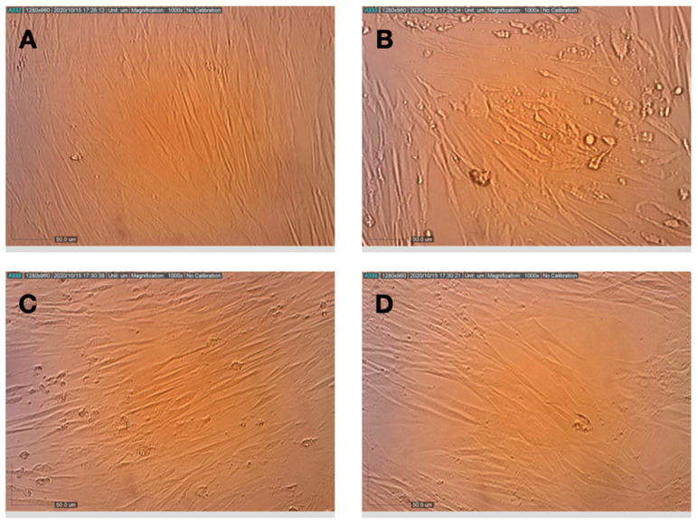 Effects of terpenes and CBD applied post-infection on the replication and cytopathic effect of HCoV-229E in MRC-5 cells. (A) Healthy MRC-5 cells, (B) MRC-5 cells at 72 h after infection with HCoV-229E, (C) MRC-5 cells that were pretreated with terpenes, photographed 72 h after infection with HCoV-229E and (D) MRC-5 cells that were pretreated with terpenes and CBD, photographed 72 h after infection with HCoV-229E.
