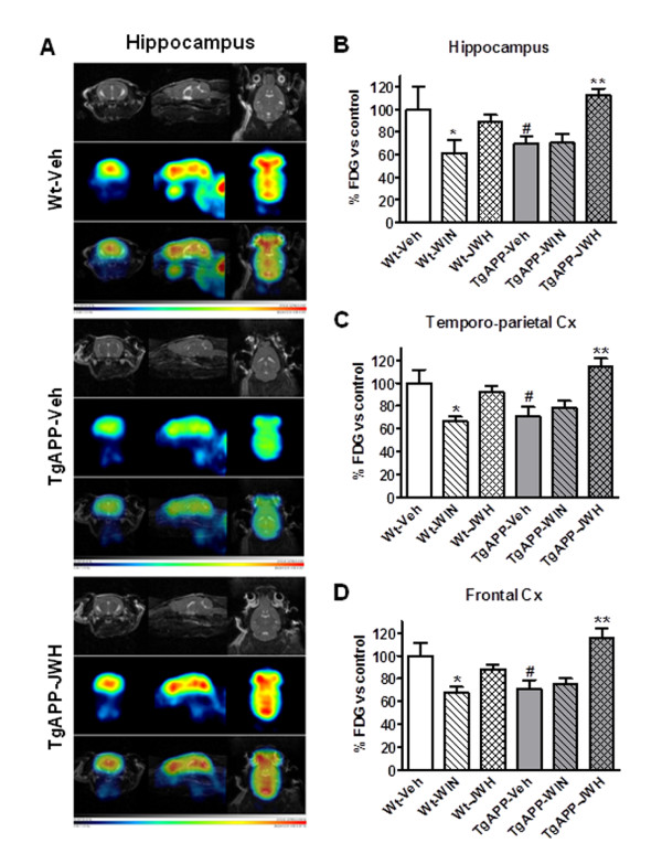 JWH oral administration rescued the decreased 18F-DG uptake in TgAPP assessed by PET. A: representative images [MR, 18F-DG uptake and merged] in hippocampus of wild type (Wt) and Tg APP vehicle treated mice. Continuous oral treatment of wild type mice with WIN decreased uptake in all regions studied (B: hippocampus; C: Frontal cortex; D: Temporo-parietal cortex). Tg APP showed decreased uptake which was normalized by JWH oral treatment (A-D). Animals were treated with vehicle or cannabinoids (0.2 mg/kg) in the drinking water for 4 months, starting at 7 months of age. Results are mean ± SEM (n = 4 mice/group) of the ratio of average radiactivity in a given region of interest (ROI) by the radiactivity in cerebellum (Cb) expressed as percentage. *p < 0.05, ** p < 0.01 vs vehicle treated mice; #p < 0.05 vs wild type-vehicle mice (ANOVA followed by Student's t test).
