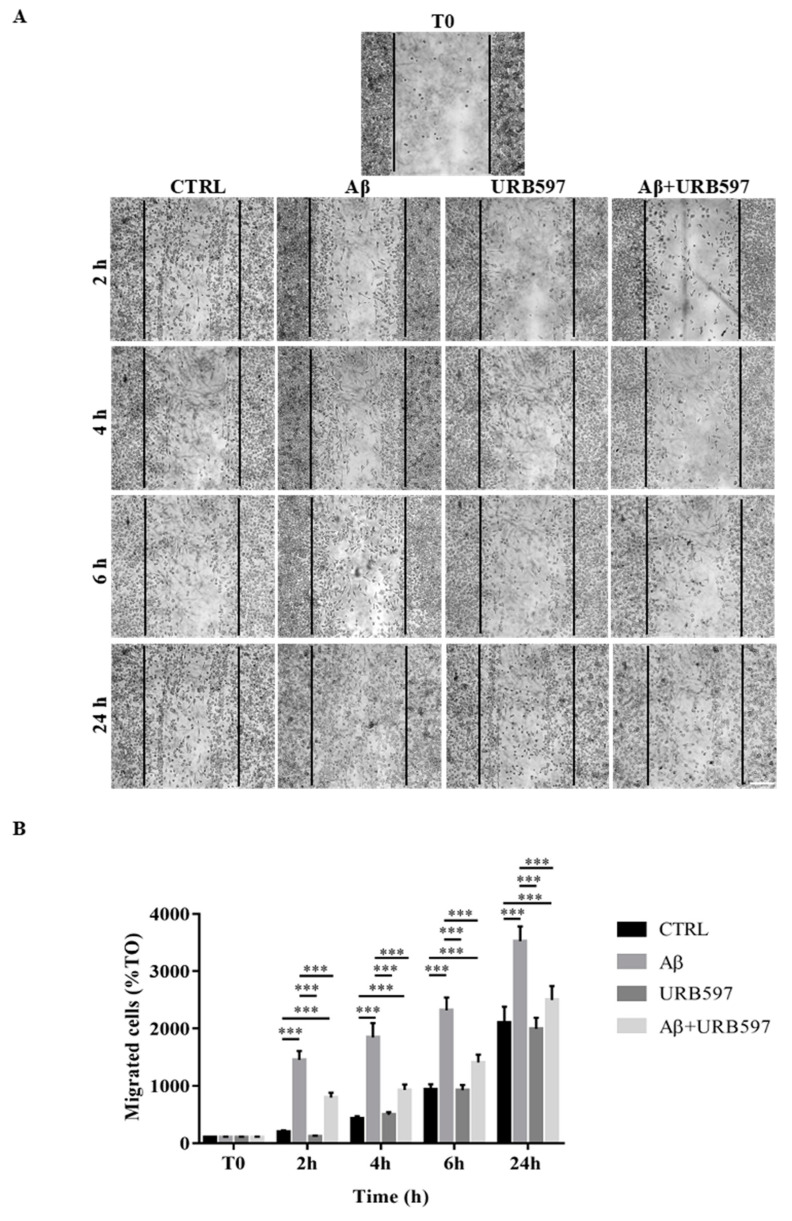 (A) Analysis of cell migration determined by scratch assay. BV-2 were pre-treated with 5 µM URB597 for 4 h in the presence or absence of 30 µM Aβ25–35 for 2 h, 4 h, 6 h, and 24 h. T0 represents the control at time 0, and CTRL the control for each time point. (B) The results were normalized vs. T0 sample and re-ported as percentage. They represent the mean ± SD of three independent experiments. *** p < 0.001. Bar: 200 μm.