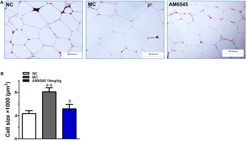 The impact of AM6545 on intraperitoneal adipose tissue mass and size in the MSG mice. (A) Representative photomicrograph of intraperitoneal adipose section. (B) The average size of adipocytes in the intraperitoneal adipose tissue. The bar indicates 100 μm in the panels (HE: 40×). NC, normal control; MC, model control; values are mean adipocyte size ± SEM, n = 8 per group; data were analyzed by one-way ANOVA followed by the multiple comparison tests. ∗∗p < 0.01 versus NC group; #p < 0.05 versus MC group.