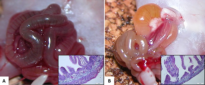 A, Macroscopic view of the intestinal evisceration of the gastroschisis (G) group (time of harvest). Inset: histological representation of ileum specimen stained with H&E of the G group. B, Macroscopic view of the intestinal evisceration of the gastroschisis+cannabidiol (GCBD) group (time of harvest). Inset: histological representation of the ileum specimen stained with H&E of the GCBD group. Note the different aspect and thickness of the bowel loop macroscopically and microscopically between the 2 groups. Masson's trichrome staining from ileum segment. Magnification: 100×. Scale bar: 10 μm.