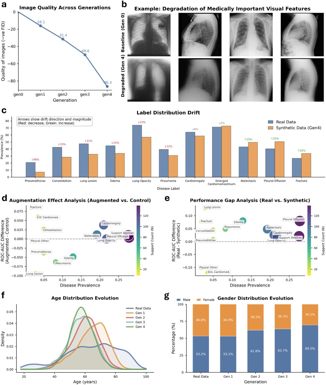 Visual degradation, pathological distortion, and demographic bias amplification driven by AI-generated data contamination in medical image synthesis.a,b, Degradation of visual fidelity. Fréchet Inception Distance (FID) scores (a) demonstrate a monotonic divergence from the real image distribution, while representative examples (b) illustrate the systematic erasure of fine-grained anatomical details required for diagnosis. c, Distortion of pathological representations. Predicted disease probability distributions across ten thoracic findings reveal the suppression of pathological signals and a convergence toward generic visual features. d,e, Failure of downstream diagnostic utility. Analysis of augmentation effects (d) shows that synthetic data provides diminishing returns compared to real data. Furthermore, classifiers trained exclusively on synthetic images (e) exhibit a widening performance gap relative to those trained on authentic data, confirming that synthetic artifacts impair discriminative learning. f,g, Amplification of demographic bias. Evolutionary analysis of patient attributes reveals a degradation of diversity: age distributions narrow toward a middle-aged norm (f), while gender representation shifts from a near-balanced baseline to a heavily male-dominant distribution (g), effectively erasing female phenotypes from the synthetic population by Generation 4.
