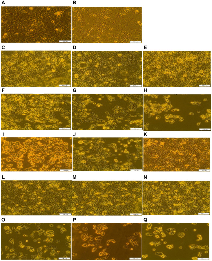 Morphological analysis of the FNBC PDT response assays with and without CBD treatment.(A) Cells only, (B) Cells + Irradiation (10 J/cm2), (C) Cells + 0.125 μM ZnPcS4, (D) Cells + 0.125 μM ZnPcS4 – AuNP-PEG5000-SH- NH2, (E) Cells + 0.125 μM ZnPcS4 – AuNP-PEG5000-SH-NH2 – Anti-GCC Ab, (F) Cells + 0.125 μM ZnPcS4 + Irradiation, (G) Cells + 0.125 μM ZnPcS4 – AuNP-PEG5000-SH- NH2 + Irradiation, (H) Cells + 0.125 μM ZnPcS4 – AuNP-PEG5000-SH- NH2 – Anti-GCC Ab + Irradiation, (I) Cells + 1 uM CBD, (J) Cells + 1 uM CBD + Irradiation, (K) Cells + ethanol, (L) Cells + 0.125 μM ZnPcS4 + 1 uM CBD, (M) Cells + 0.125 μM ZnPcS4 – AuNP-PEG5000-SH- NH2 + 1 uM CBD, (N) Cells + 0.125 μM ZnPcS4 – AuNP-PEG5000-SH- NH2 – Anti-GCC Ab + 1 uM CBD, (O) Cells + 0.125 μM ZnPcS4 + 1 uM CBD + Irradiation, (P) Cells + 0.125 μM ZnPcS4 – AuNP-PEG5000-SH- NH2 + 1 uM CBD + Irradiation and (Q) Cells + 0.125 μM ZnPcS4 – AuNP-PEG5000-SH- NH2 – Anti-GCC Ab + 1 uM CBD + Irradiation.