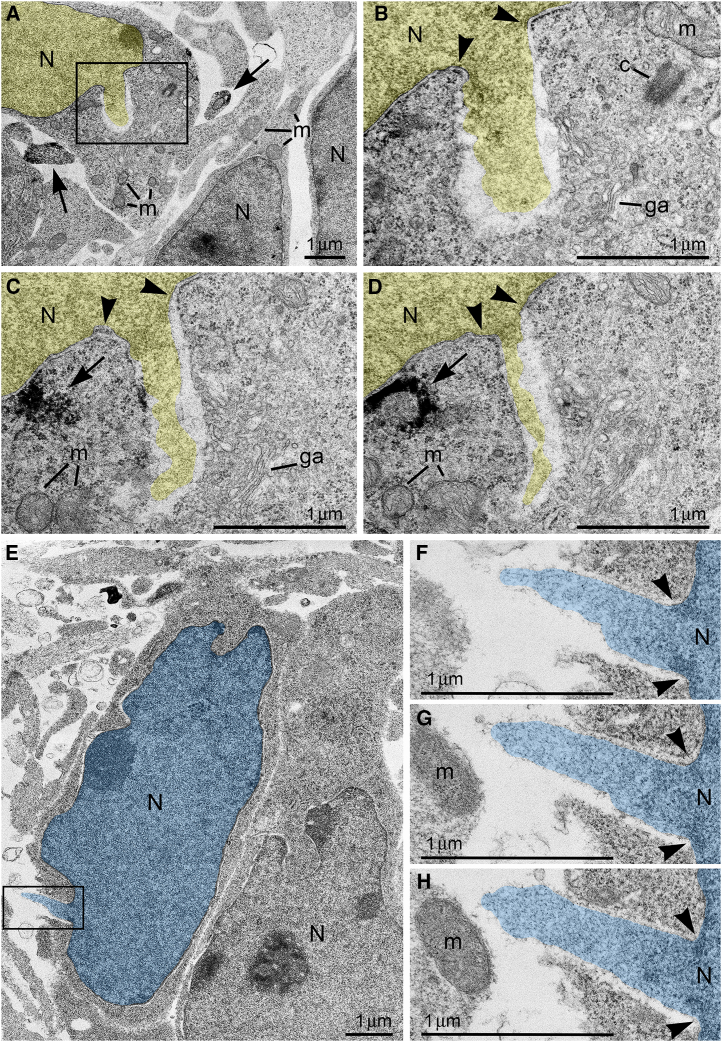 Ultrastructure of herniated chromatin streams(A–D) NE rupture in a neuron from the cortical plate of wildtype mouse embryo exposed to high dose (0.12 mg/kg) of CB1R agonist CP-55940. (A) Low power micrograph shows ultrastructure of neuronal cell bodies and neuropil that is generally normal for the developmental stage. (B–D) Serial high power images of NE rupture from the framed area in (A). Chromatin stream expelled from the nucleus (pseudo-colored yellow) is not surrounded by the nuclear membranes. Arrowheads indicate points of interruption of the nuclear membranes. Arrows point to CB1R-positive axons in (A) and CB1R-positive intracellular vesicle in (C) and (D).(E–H) Piercing nuclear hernia (PNH) in a neuron from the cortical plate of CB1R−/− embryo. (E) Low power micrograph shows generally normal ultrastructure of neurons. (F–H) Serial high power images of PNH from the framed area in (E). Note the continuum of the chromatin stream expelled from the nucleus (pseudo-colored blue) and penetrating the intercellular space. Arrowheads indicate points of interruption of the nuclear membranes. Abbreviations: c, centriole; ga, Golgi apparatus; m, mitochondria, N, nucleus.