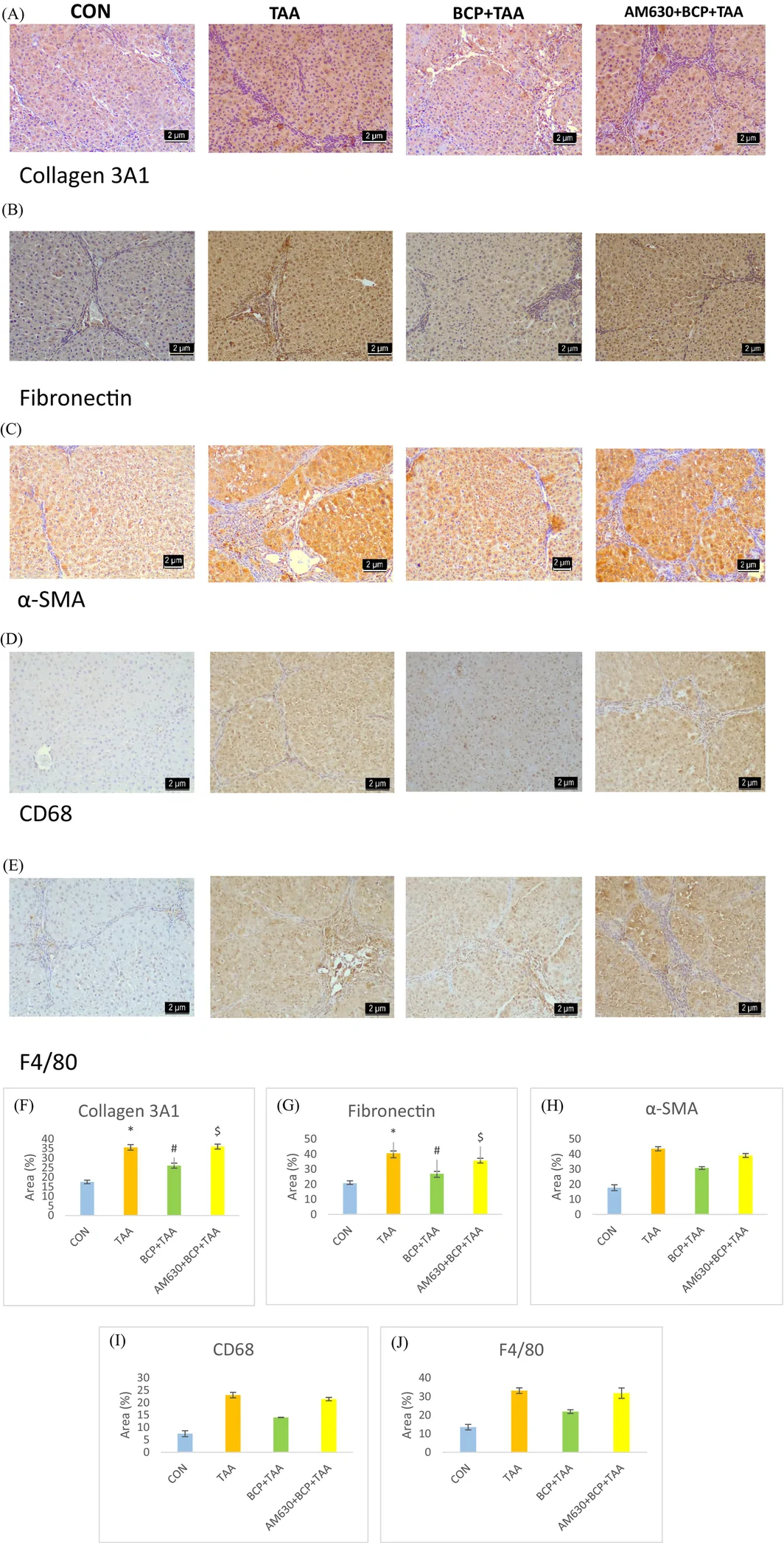 Immunohistochemical staining of (A) COL3A1, (B) Fibronectin, (C) α‐SMA, (D) CD68+ and (E) F4/80+. (F–J) Quantification of the corresponding markers. Scale bar = 2 μm. CON: Control, BCP + TAA: β‐Caryophyllene+ Thioacetamide treatment, AM630 + BCP + TAA: AM630 + β‐Caryophyllene + Thioacetamide.