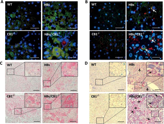 a Double immunofluorescence analysis of paraffin-embedded liver sections of 52-week-old mice was performed using specific anti-LC3B (green) and LAMP1 (red) antibodies. Nuclei were stained with DAPI (blue). Colocalization of these two proteins appears in yellow. Magnification ×1000 Scale bar 40 µm. b Representative double immunofluorescence analysis of paraffin-embedded liver sections from 52-week-old mice was performed using anti-p62 (green) and anti-LAMP1 (red). Arrowheads indicate colocalization of these proteins shown in yellow color and p62 accumulation in nuclear inclusion. Original image magnification ×1000, bars 40 µm. c Representative immunohistochemical analysis of paraffin-embedded liver sections from 52-week-old mice was performed using specific anti-LAL (lysosomal acid lipase) antibody. Original magnification ×200 and ×1000, bar 100 µm. d Representative immunohistochemical analysis of PLIN2 (blue) and LAMP1 (red). Arrows show costained areas (purple color). Original magnification ×200 and ×1000, bar 100 µm