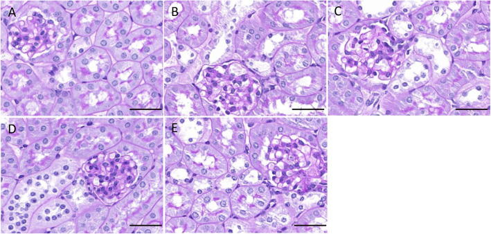 CIH causes renal damage. Changes in renal tissue morphology in each group were observed by PAS staining. a: NC; b: 4w CIH; c: 6w CIH; d: 4w CIH + Ri; e: 6w CIH + Ri. Original magnification, × 200. Scale bars, 50 μm