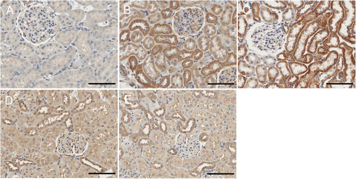 CIH increases renal CB1R levels, which are attenuated by rimonabant. CB1R immunohistochemistry in renal tissue in each group. a: NC; b: 4w CIH; c: 6w CIH; d: 4w CIH + Ri; e: 6w CIH + Ri. Original magnification, × 200. Scale bars, 50 μm
