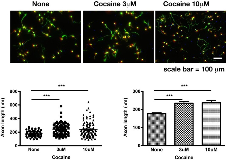 Cocaine increases the length of axons in mouse primary cortical neurons. Cocaine was added into the culture when medium was being refreshed daily from DIV 7 to DIV 10. Data were collected on DIV 10. Note: (1) Dendritic spines were not formed until DIV 14. Therefore, synapses were not present at the time of data collection; (2) There was no dopamine in the medium. Data represent combined results from three sets of independent experiments. Green: axons and soma labeled by pNF-H; Red: dendrites labeled by MAP-2B; Blue: nuclei labeled by DAPI. Total numbers of axons examined were 68, 94, and 102, respectively, for saline, 3 μM cocaine, 10 μM cocaine. ∗∗∗p < 0.0004 or 0.0001 (two-tailed t-test).