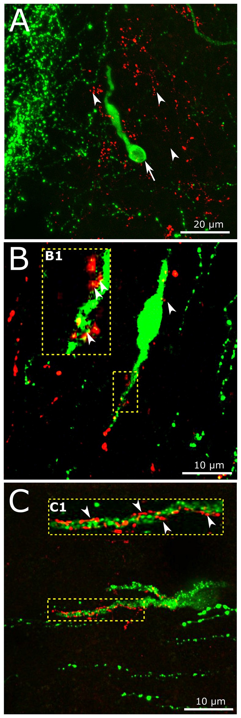 Interaction of central GLP-1 and GnRH neuronal systems. (A) Red GLP-1-immunoreactive (IR) axons (arrowheads) and a green GnRH-IR neuron (arrows) appear in the vicinity of the vascular organ of lamina terminalis (OVLT) of the mouse brain. (B,C) GLP-1-IR axons establish contacts with the dendrites (enframed by dotted line) of a subset of GnRH neurons exhibiting smooth (B) or rough (C) surface. The multiple contacts (arrowheads) are shown at higher power in insets (B1,C1).