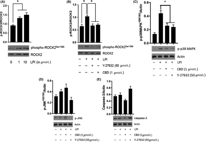 LPI induces ROCK2 and p38 MAPK activation in murine iPSC cardiomyocytes. LPI (1 & 10 μmol L−1) produced a concentration‐dependent increase in ROCK2 phosphorylation (Panel A; *P < 0.05 vs control) that was completely inhibited in the presence of both Y‐27632 (50 μmol L−1) and CBD (1 μmol L−1) (Panel B; *P < 0.05 vs LPI response). LPI also induced p38 MAPK activation that was sensitive to both Y‐27632 and CD (Panel C; *P < 0.05 vs LPI response). In contrast, there was no evidence of significant JNK activation (Panel D) or caspase‐3 cleavage (Panel E) in response to challenge with LPI. Data (mean ± SEM) is expressed as the ratio of phosphorylated to total protein (corrected for protein content); n = 3 experiments performed on separate cell preparations. Western Blots are representative results