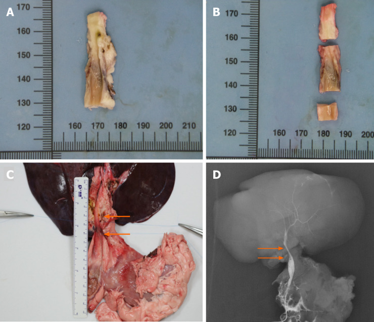 Autopsy and cholangiography. A: The macroscopic assessment of the extrahepatic bile duct (BD) indicated the inner walls of the anastomoses were smooth without scars or stricture; B: The extrahepatic BD was divided into three segments to perform the microscopic assessment according to the anastomoses; C: The en bloc liver procured was associated with the entire extrahepatic BD including partial duodenum and pancreas after euthanasia. The area of two white arrows denoted the location of the animal-derived artificial bile duct (group B); D: The cholangiography showed patency of the animal-derived artificial bile duct without dilatation of the proximal BD. The area of two white arrows denoted the location of the animal-derived artificial bile duct (group B).