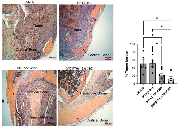 Histological examination of mice tibia-treated PTH Antagonists-representative H&E images of breast tumor in the tibia marrow and the surrounding space. Mice tibia were inoculated with 2.5 × 105 MDA-MB-231-BM/luc+ cells. After euthanasia, the tibia was removed, fixed, decalcified, sectioned, and stained with H&E representative 5 × images for each treatment group are shown. Cortical bone, trabecular bone, and tumor in the bone were labeled. The bar graph shows the percentage tumor burden in bone measured using ImageJ software. * p < 0.05.