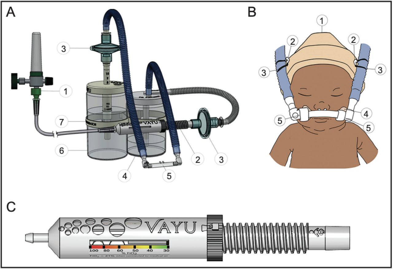 A: The bubble CPAP system is composed of (1) an external pressurized oxygen source (2) a Venturi blender (3) two bacterial viral filters, one on inspiratory and one on expiratory limb (4) humidifier (5) nasal prongs (6) pressure generator with an adjustable wand and (7) a warmer bracket B: (1) hat; (2) two safety pins, (3) two rubber bands, (4) hook mustache, and (5) soft loop fasteners. C: Vayu blender