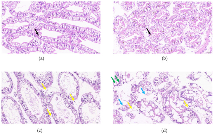 Histological sections of hepatopancreas after drought. (a) Control and drought exposure for (b) 1, (c) 3, and (d) 5 days. Vacuole with yellow pigment (black arrow), inflammatory cell (yellow arrow), oozing protein fluid (blue arrow), vacuole (marked by green arrow). H&E stain (200×).