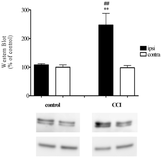 Western blot analysis of LOX-15 protein levels measured in the lumbar dorsal horn (L5–L6) of the spinal cord on day 7 of control (sham) and CCI in rats.The data are presented as means ± SEM, which represent GAPDH (lower line) normalized averages derived from 6 samples per each group Results are presented as a % of control densitometry analysis of all sections. Statistical analyses were performed with one-way ANOVA with Bonferroni as post-hoc test. **p<0.01 ipsilateral versus contralateral of CCI-exposed rats and ## p<0.01 CCI ipsilateral versus control (naïve and sham) rats.