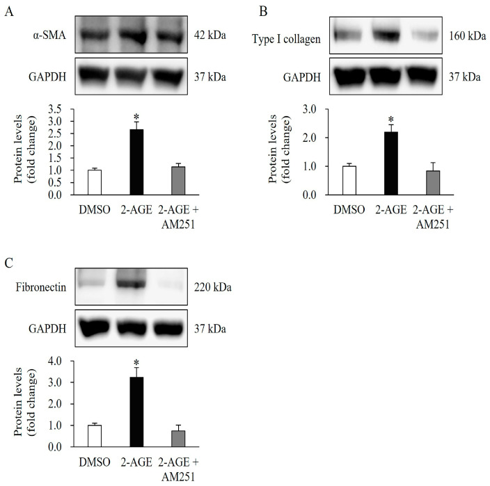 Effects of cannabinoid receptor 1 (CB1) antagonist on the expression of differentiation markers upregulated by CB1 agonists in human dermal fibroblasts (HDFs). AM251 (10 μM), a CB1-selective antagonist, was administered for 1 h prior to treatment with 2-arachidonyl glyceryl ether (2-AGE; 2.5 μM), a CB1-selective agonist, for 48 h. Western blot analysis showing that AM251 treatment abolished the upregulated expression of (A) alpha-smooth muscle actin, (B) type I collagen, and (C) type III collagen induced by 2-AGE treatment alone. Data are presented as mean ± SD, n = 3 per group. * p < 0.05 vs. dimethyl sulfoxide-treated control cells, which were set to 1.0.