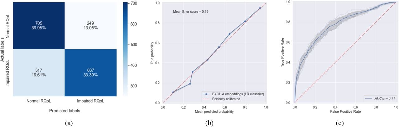 Performance of the best model (fused BYOL-A deep audio embeddings and socio-demographic/clinical features, trained with logistic regression classifier): a) Confusion matrix; b) Probability calibration curve; and c) ROC curve. Light blue lines denote the ROC curves across 5 cross-validation folds, whereas a thick blue line represents the average ROC curve. Standard deviation is highlighted with the shaded area.