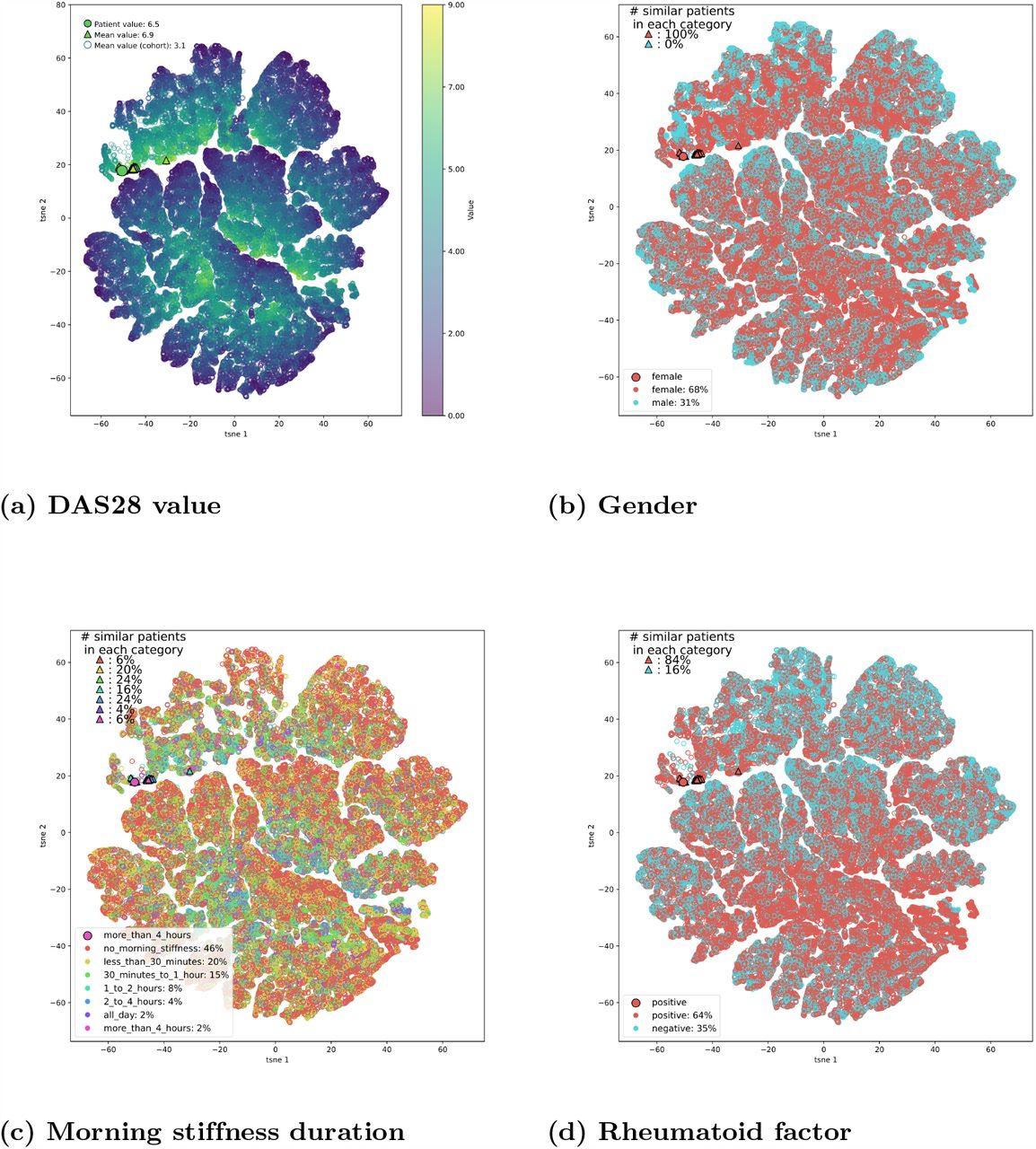 The DAS28 score and gender show a high level of consistency among the closest neighbors of this patient. Duration of morning stiffness and rheumatoid factors also show slight distribution shifts within the subsets of nearest neighbours.