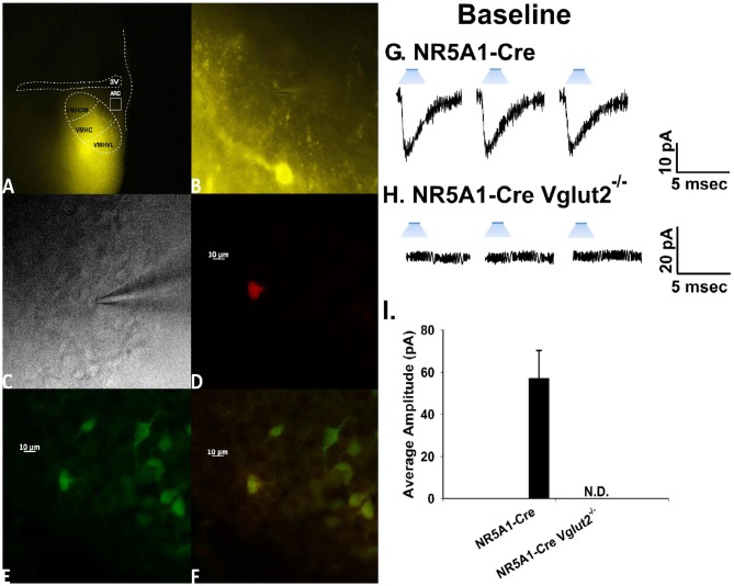 Photostimulation elicits glutamatergic EPSCs at VMN steroidogenic factor (SF-1)/ARC POMC synapses. (A) ChR2 labeling in the VMN of a male NR5A1-Cre mouse visualized at ×4 with enhanced yellow fluorescent protein (eYFP) 2 weeks after injection with a ChR2-containing virus. Of note is the gradient extending from the dorsomedial VMN (VMHDM) to the ventrolateral VMN (VMHVL) that is characteristic of the distribution of VMN SF-1 neurons. (B) Magnified view of the outlined approximate recorded area in the ARC from (A) showing labeling of ChR2-containing fibers in the ARC visualized with eYFP. (C) An infrared, differential interference contrast image taken of an ARC neuron in close proximity to the eYFP-labeled fibers seen in (B). (D) Biocytin labeling of the cell in (A) visualized with streptavidin/Alexa Fluor 546. (E) An antibody directed against cocaine- and amphetamine-regulated transcript (CART), a phenotypic marker of POMC neurons, immunolabels the cell in (C) as visualized with Alexa Fluor 488. (F) A composite overlay of the biocytin/CART labeling seen in the cell in (A). Unless otherwise indicated, all photomicrographs were taken at ×40.A 25-ms stimulus of blue light subsequently delivered to the cell in (C–F) elicited robust light-evoked EPSCs (leEPSCs; G) that were indiscernible in recordings from NR5A1-creVglut2−/– animals (H). This is further illustrated in the composite bar graph in (I) Bars represent means and lines 1 SEM of the EPSC amplitude measured in slices from NR5A1-Cre (n = 22) and NR5A1-CreVglut2−/– (n = 3) animals.